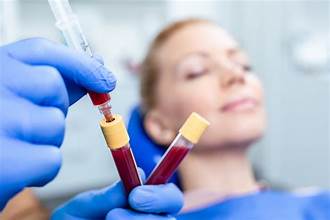 PRP Therapy Treatment Dubai at Cosmocare Medical Center